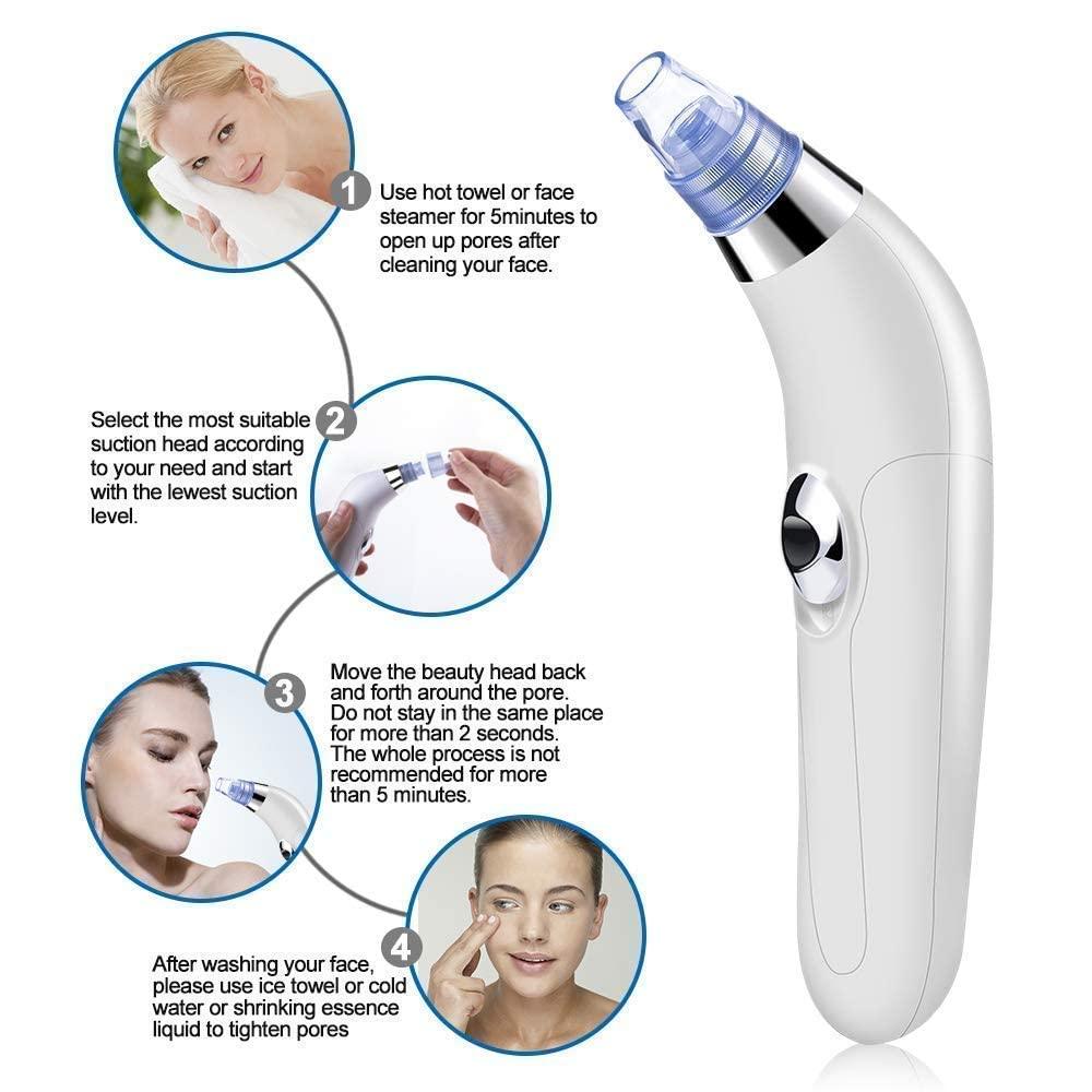 Black Head Remover - 961stores