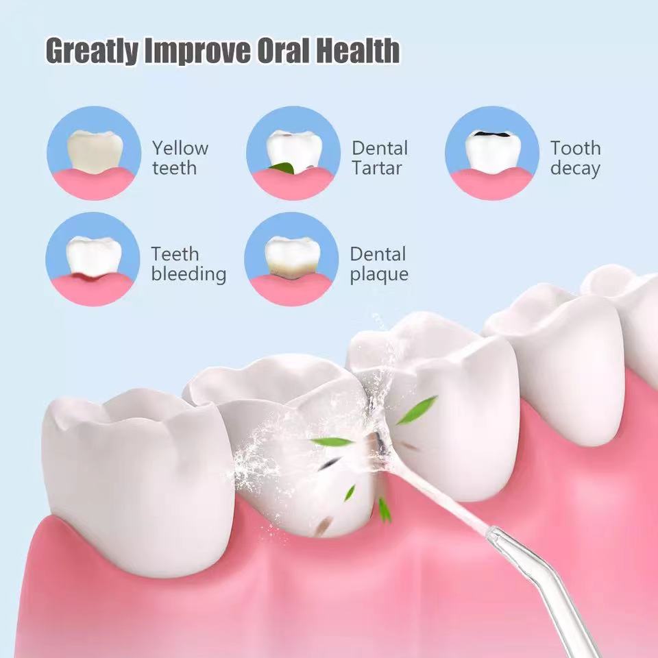 Electric Oral Irrigator
