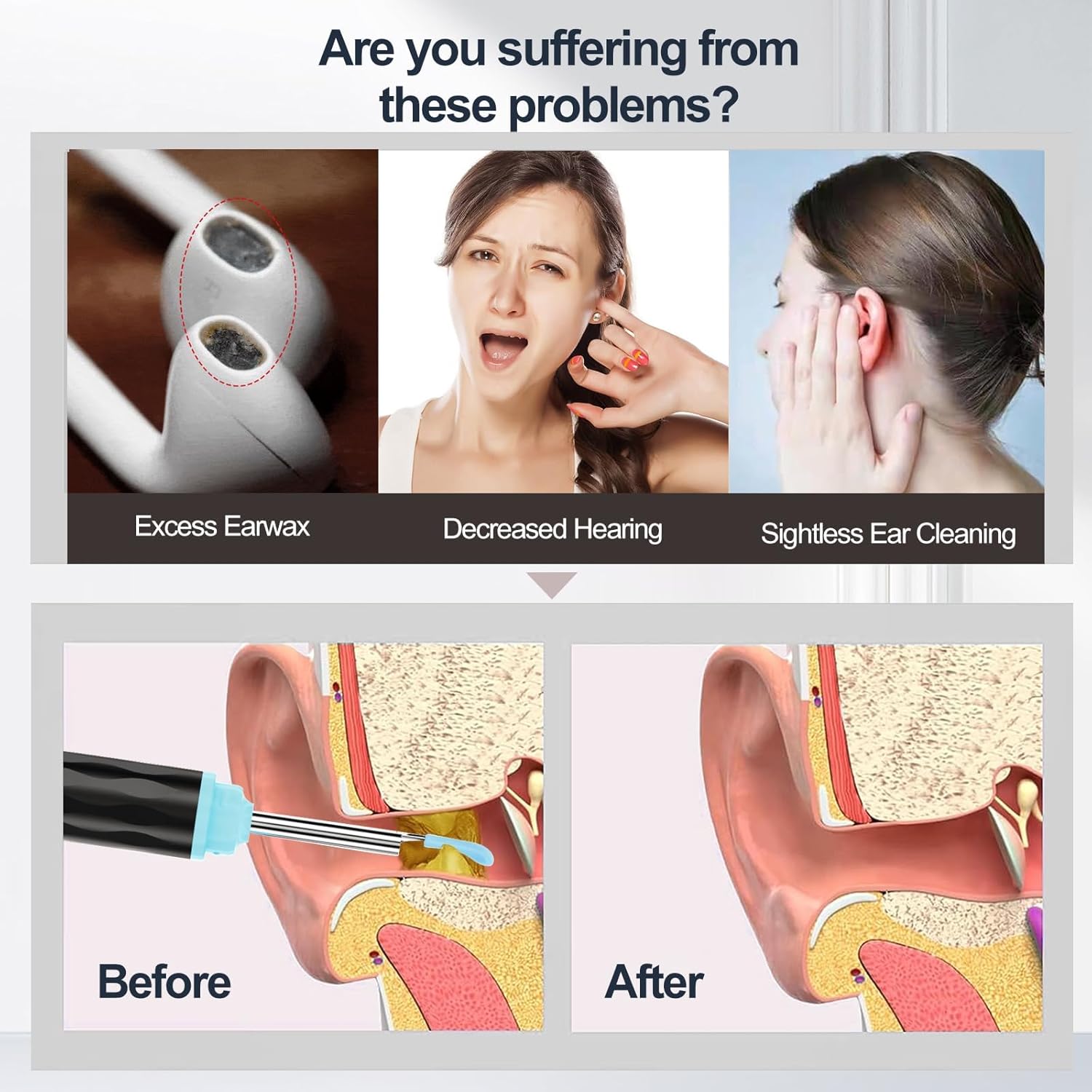 Smart WiFi Ear Cleaner Camera