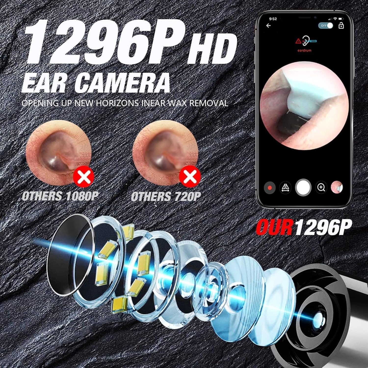Smart WiFi Ear Cleaner Camera