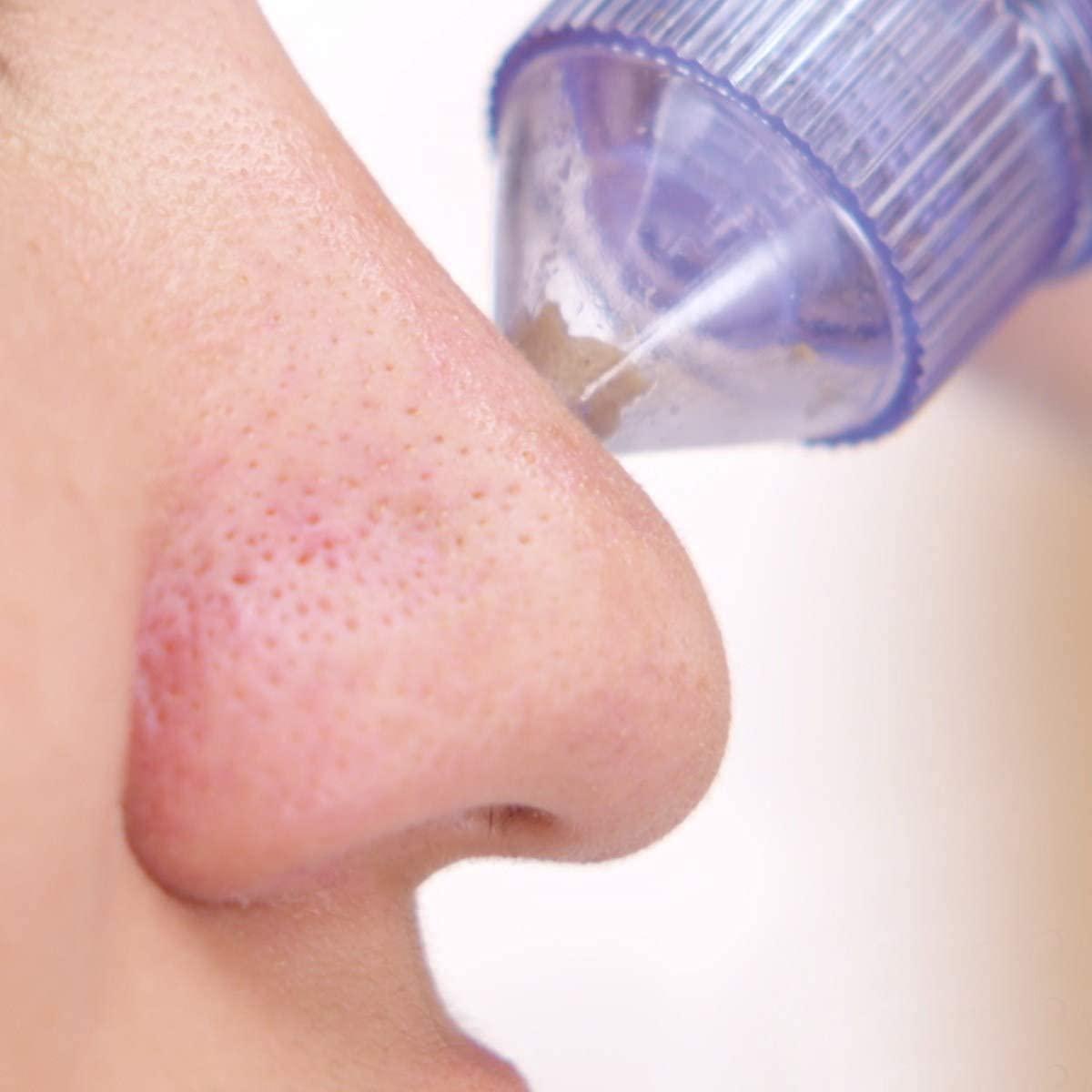 Black Head Remover - 961stores