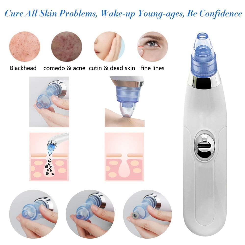 Black Head Remover - 961stores