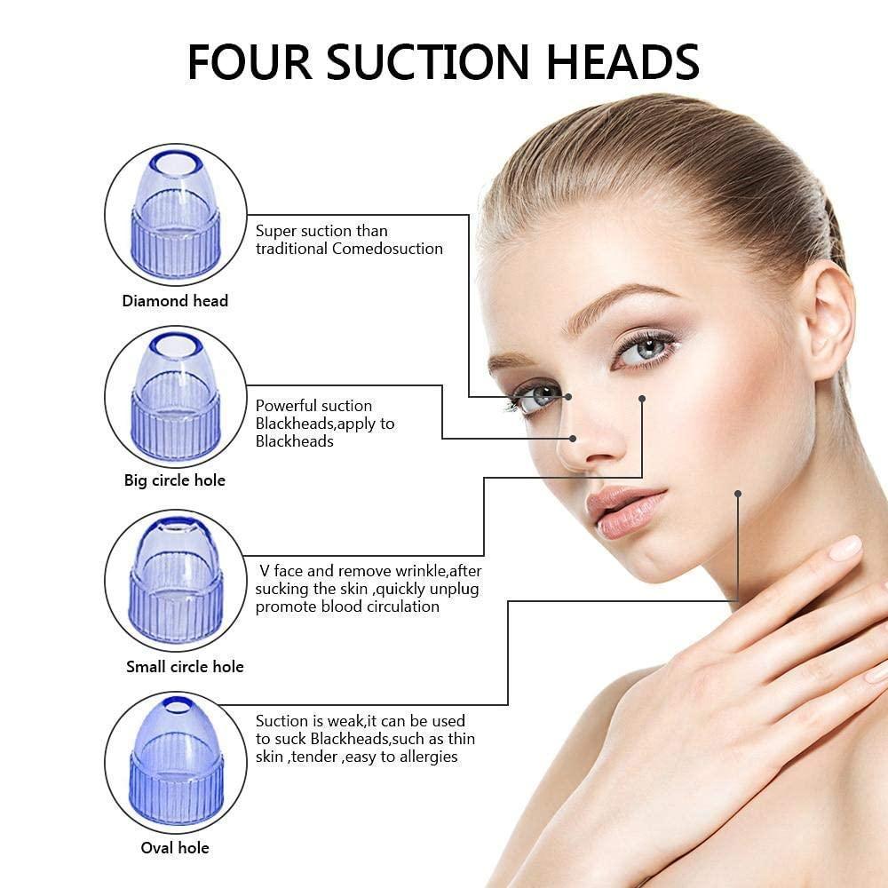 Black Head Remover - 961stores