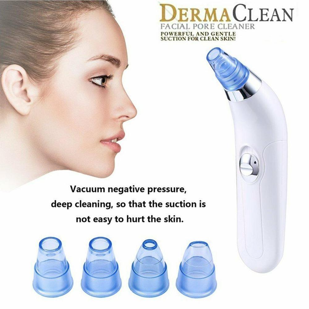 Black Head Remover - 961stores