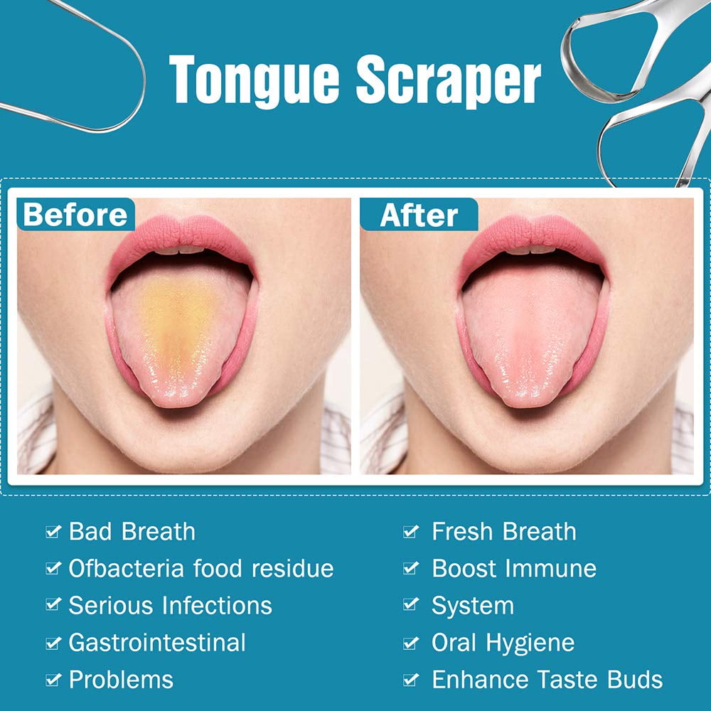 Tongue Scrapers Set (3 Pcs)